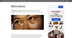 Desktop Screenshot of bilirrubina.net